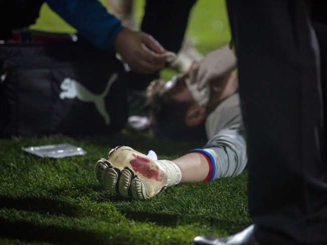 Silviu Lung goalkeeper from Astra Giurgiu suffered a collision with another player in a game played in Galați, Romania on October 20th, 2012.